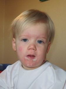 Lille mus med skarlagensfeber