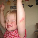 Karens lille sår på albuen